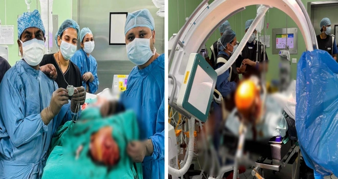 Sharda Health Care News : “दिमाग की सर्जरी में ग्रेटर नोएडा ने रचा इतिहास!, कांपते हाथों को मिला कंट्रोल—शारदा केयर ने पहली बार DBS से लिखी नई मेडिकल कहानी”, “त्वचा के नीचे फिट होगा ‘ब्रेन कंट्रोल डिवाइस’—रिमोट से चलेगा इलाज”, “ग्रेटर नोएडा बनेगा न्यूरोसर्जरी का नया हब!”