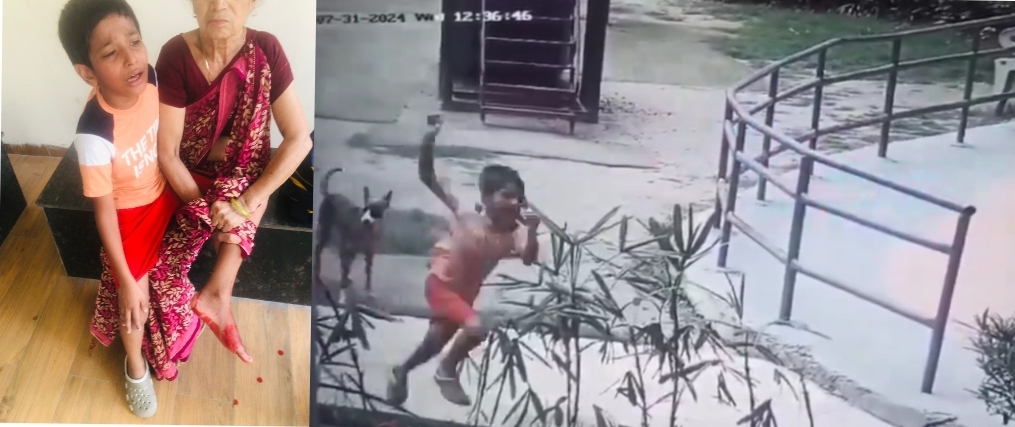 Greater Noida West News: अजनारा होम्स सोसायटी में स्ट्रीट डॉग्स का आतंक, पार्क में खेल रहे बच्चे को किया लहूलुहान, निवासियों में बढ़ रहा है गुस्सा