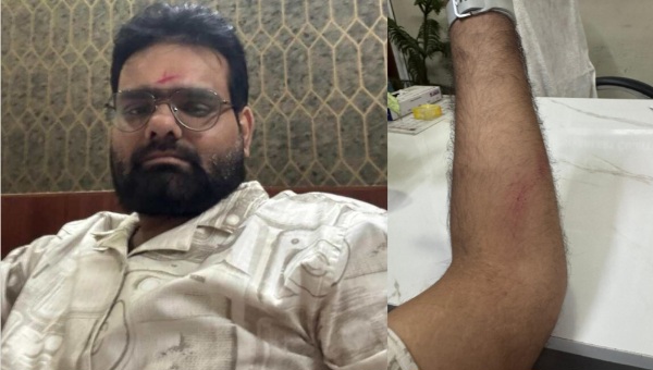 Greater Noida West News : ग्रेटर नोएडा वेस्ट में अधिवक्ता पर हमला, वकील अशुतोष श्रीवास्तव पर हमले में कार्रवाई की मांग