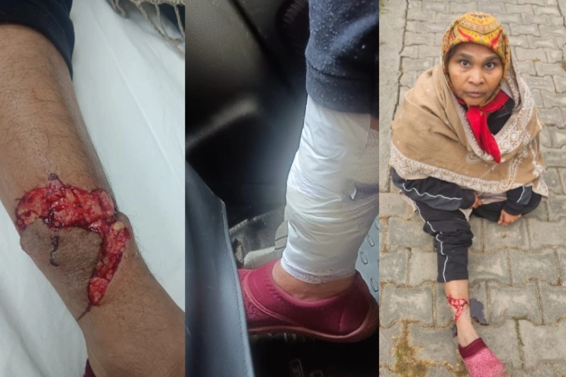 Dog Breaking News : “कुत्तों का डर, इंसानों की बेबसी!”, ग्रेटर नोएडा सेक्टर MU-2 में आवारा कुत्तों का कहर, मॉर्निंग वॉक बनी खौफनाक—महिला पर झुंड ने किया जानलेवा हमला, प्राधिकरण की चुप्पी पर उठे गंभीर सवाल
