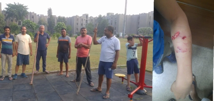 Breaking News : "मुहल्ले में मचा खौफ, हाथों में डंडे लेकर निकल रहे लोग! ग्रेटर नोएडा के म्यू-2 सेक्टर में ‘आतंक’ बने स्ट्रीट डॉग, एक ही दिन में 5 लोगों पर हमला, 12 वर्षीय बच्ची का इलाज पहुंचा एक लाख रुपये तक"