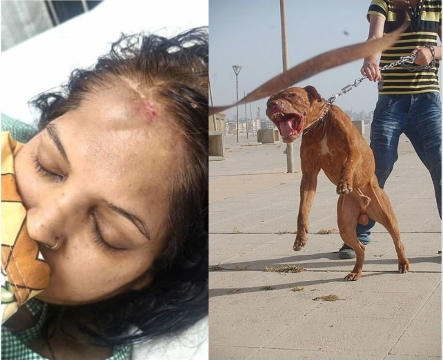 Greater Noida Pitbull Attack : ग्रेटर नोएडा में पिटबुल का खौफ, महिला पर जानलेवा हमला… 15 मिनट तक जबड़े में फंसा रहा हाथ, पार्क में कुत्तों की एंट्री पर लगी रोक, इलाके में दहशत, पार्क में आने से डर रहे लोग, पार्क में कुत्तों की एंट्री पर रोक, उल्लंघन पर लगेगा जुर्माना, प्रशासन से सख्त कार्रवाई की मांग