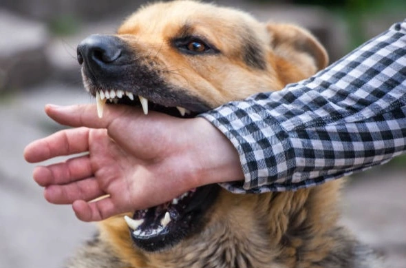 Dog Attack Kids : “पालतू कुत्ते का खौफ!”, ग्रेटर नोएडा की सोसायटी में खेल रहे 13 साल के बच्चे पर हमला, शिकायत के बाद मालिक पर पुलिस ने दर्ज किया मुकदमा, पैर में गंभीर जख्म, परिवार में दहशत